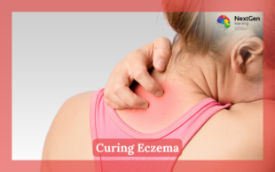Curing Eczema