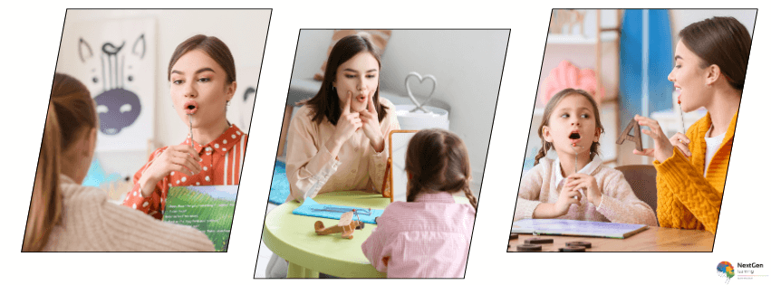 apraxia and dysarthria course