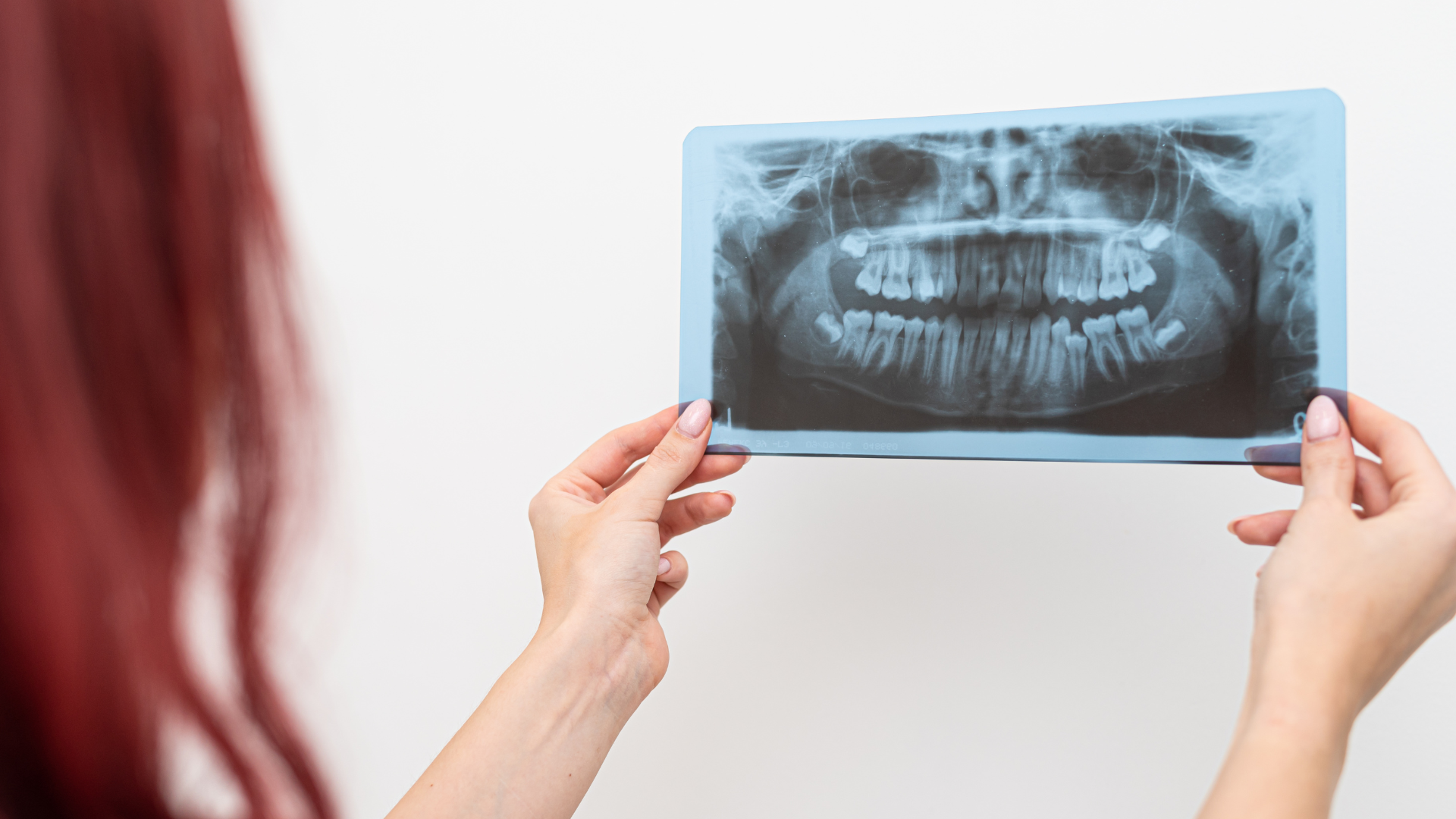 Dental Radiography Next Generation Learning